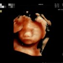 라엘르의원 | 임신 17~22주차 | 모성보호시간(단축근무) 사용 | 정밀초음파 검사 | 쌍둥이 태아보험 가입