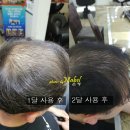 보령카크리닉 이미지