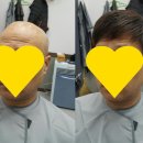 가발히트모