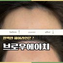 (주)에이치유엠 | 충주 왁싱샵 “브로우에이치” 헤어라인 왁싱 후기