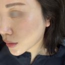 어서오세요 약국 | 상봉피부관리 바이오폭스 10-GF 마이크로젯 후기 상봉 에스테틱 리브르 피부관리 나만의 또간집 ::