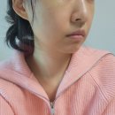 (주)바로닥터 | 고주파 뷰티디바이스 닥터탱글 하이퍼부스터 내돈내산 한달사용후기