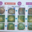 큐사랑(단계점)