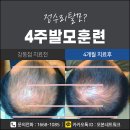 모본한의원 | 문정탈모치료 이젠 걱정하지 말라구요!