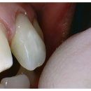 대륙치과기공소 이미지