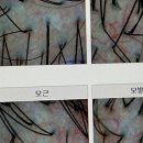 웰킨구월점 | 인천 두피관리, 이제 내 머리카락에 희망이 보여요! 웰킨두피케어젠 구월점 방문기