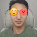 (주)이라디아 | 인천 송도피부과 올리디아 콜라겐주사 스킨부스터 후기 어려지는 느낌이 좋다