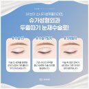 서울라인성형외과의원 이미지