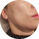 뷰티다룸 영등포점 | 영등포구청역 피부관리 뷰티다룸 에어젯 후기