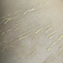 일루젼 | 안양 일루젼스칼프 후기 │ 튼살커버, 헤어라인, 눈썹커버 자연스럽게 해결