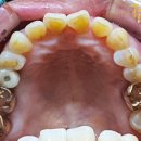 광교중앙로 이미지