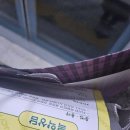 연세이비인후과의원 | 뉴연세이비인후과 편도부분절제 후기 - [수술당일 ~ 1일차] | 전체절제와 비교