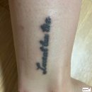 클린타투의원 | 강남 클린타투의원 5cm 타투 제거 후기 1편(내돈내산)