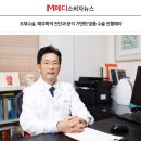 국원석성형외과의원 | 코재수술, 해부학적 진단과 분석 기반한 맞춤 수술 진행해야