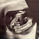 어진동_세종파이낸스3차앞 | [나의 임신일기] 임신5개월차 증상 및 할일 - 2차기형아검사 와 행복이 성별확인, 서산부인과에서...