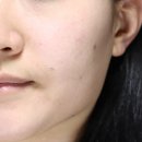 비엠메디 | 올리브영 콜라겐 마스크팩 추천 메디엔서 레티놀 실타래팩 모공 주름케어