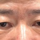 유스앤영의원 네이버블로그