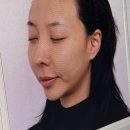 부산 해운대 온다리프팅 탄력 효과 솔직한 후기