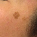 아비쥬의원 이미지