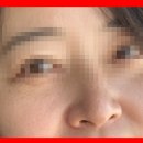 백옥 티스토리
