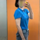 사진병원 | 팔뚝지흡후기 구월동다이어트 병원 2개월차 (전후사진, 붓기, 통증, 가격)