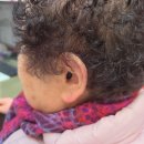 미국보청기 | 광명보청기 실제 구입 후기 전문센터 비교