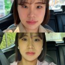 (주)셀코 | 셀비젼 쎄라쥬 내돈내산 후기 홈케어 리프팅 디바이스 한달 사용 솔직후기
