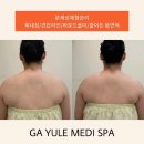 대구학정초등학교 | 대구 북구 피부관리 착붙테콜테 후기 가율메디스파