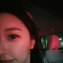 더왈츠 | 강남역 입술필러 후기 - 더왈츠의원 말린입술 자연스럽게 볼륨 채우기