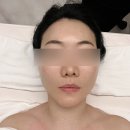 맑은선피부관리실 | 얼굴윤곽 수내피부관리실 '선에스테스파 분당점' 후기