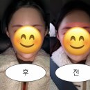 리윤솔루션 | [경기도 이천] 리프팅 무제한 샷 리윤에스테틱 방문후기