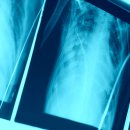 수동갈비 이미지