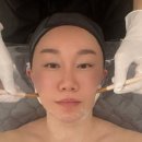 너의뷰티 | 신천동 윤곽관리 동대구역 리프팅 잘하는 예쁜너뷰티 v라인리프팅후기