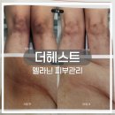 신안동2 | 광주 북구 신안동 피부관리 더헤스트 | 운암동 멜라닌 케어 후기