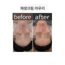 개금3동-30 | 부산에스테틱 수에스테틱에서 여드름관리 받고 온 리얼후기