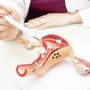 온아한의원 월배월성점 | 심한 생리통이 발생하는 주요 원인