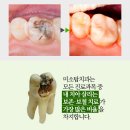 강동미소치과의원 네이버블로그