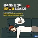 알콜성 치매 전조증상 이미지