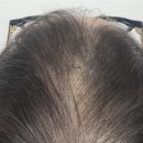 하프톤 스칼프 이미지