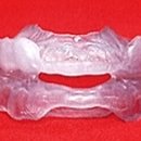 이플랜트치과의원 이미지