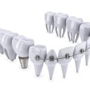 덴티치과의원 이미지