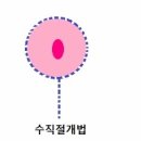 미큐의원