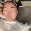 이노뷰티 | 구월동 여드름 압출 잘하는 곳, 뷰티리셋 솔직 후기