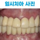 공백치과기공소 이미지