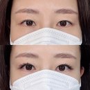 고운:눈 의정부점 | [의정부 속눈썹 연장] 더블 연장 고운눈 더블 연장 후기! 출근시간 단축(러시안 볼륨 전문)
