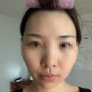 크레오의원 | (서울) 함익병 피부과 후기 (1) 내돈내산