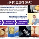 캐드캠치과기공소 이미지