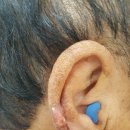 믿음보청기 이미지