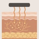 해운대센텀이비인후과의원 | 해운대센텀피부과, BEST 리프팅 3종 비교하면 답 나옵니다