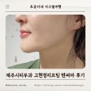 한지방 | 제주시피부과 고현정리프팅 텐써마 300샷 후기
